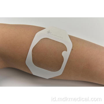 IV cannula transparan film dressing 6 * 7cm untuk perawatan luka